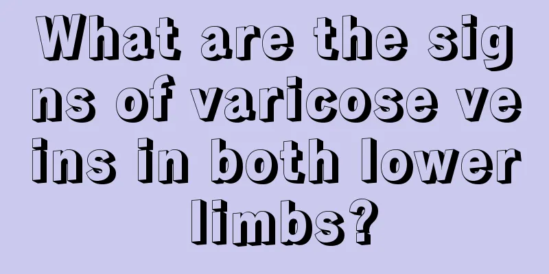 What are the signs of varicose veins in both lower limbs?